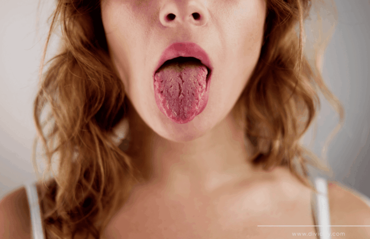Harvard alerta: cor da língua pode revelar doenças graves — e sua alimentação tem tudo a ver com isso
