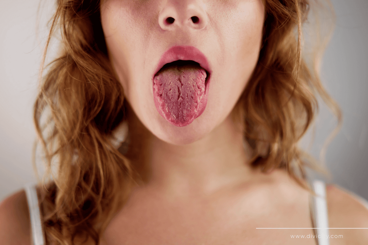 Harvard alerta: cor da língua pode revelar doenças graves — e sua alimentação tem tudo a ver com isso