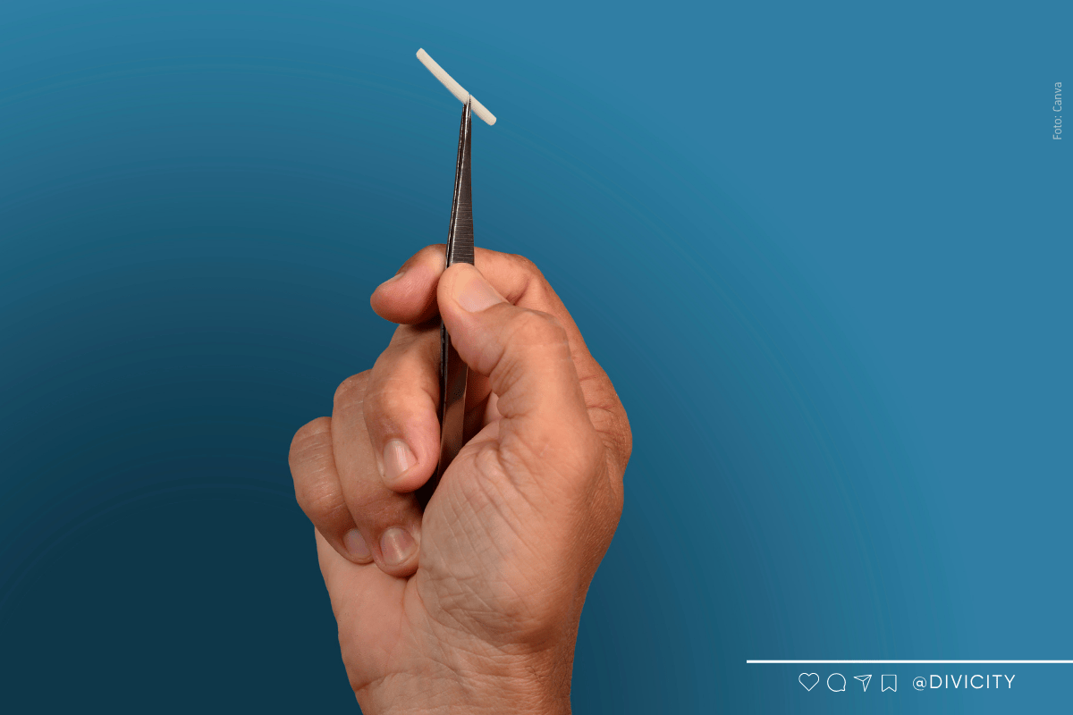 SUS vai oferecer implante contraceptivo de longa duração e alta eficácia a partir do segundo semestre